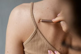 Tempo nublado não afasta o perigo do câncer de pele, afirma dermatologista Tempo nublado não afasta o perigo do câncer de pele, afirma dermatologista